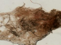 Lendenfeldia dendyi image