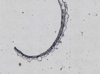 Celleporella cornuta image